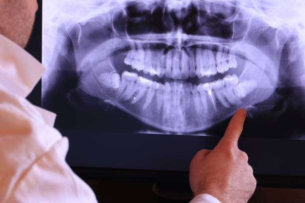 Best Cracked Tooth Emergency Dentist  in Weston Mills, NY