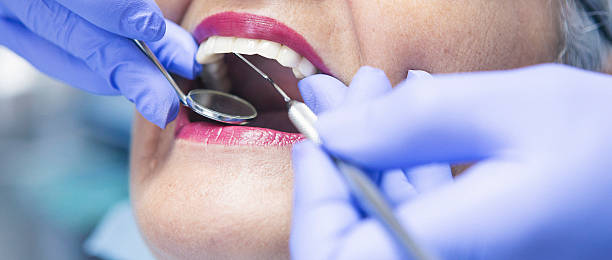 Best Chipped Tooth Repair Near Me  in Weston Mills, NY